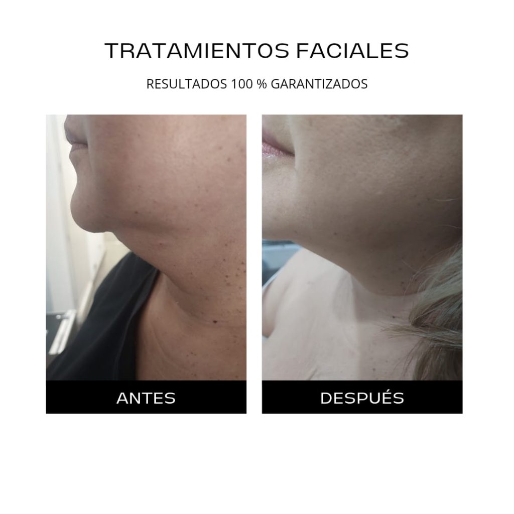 Procedimientos 6