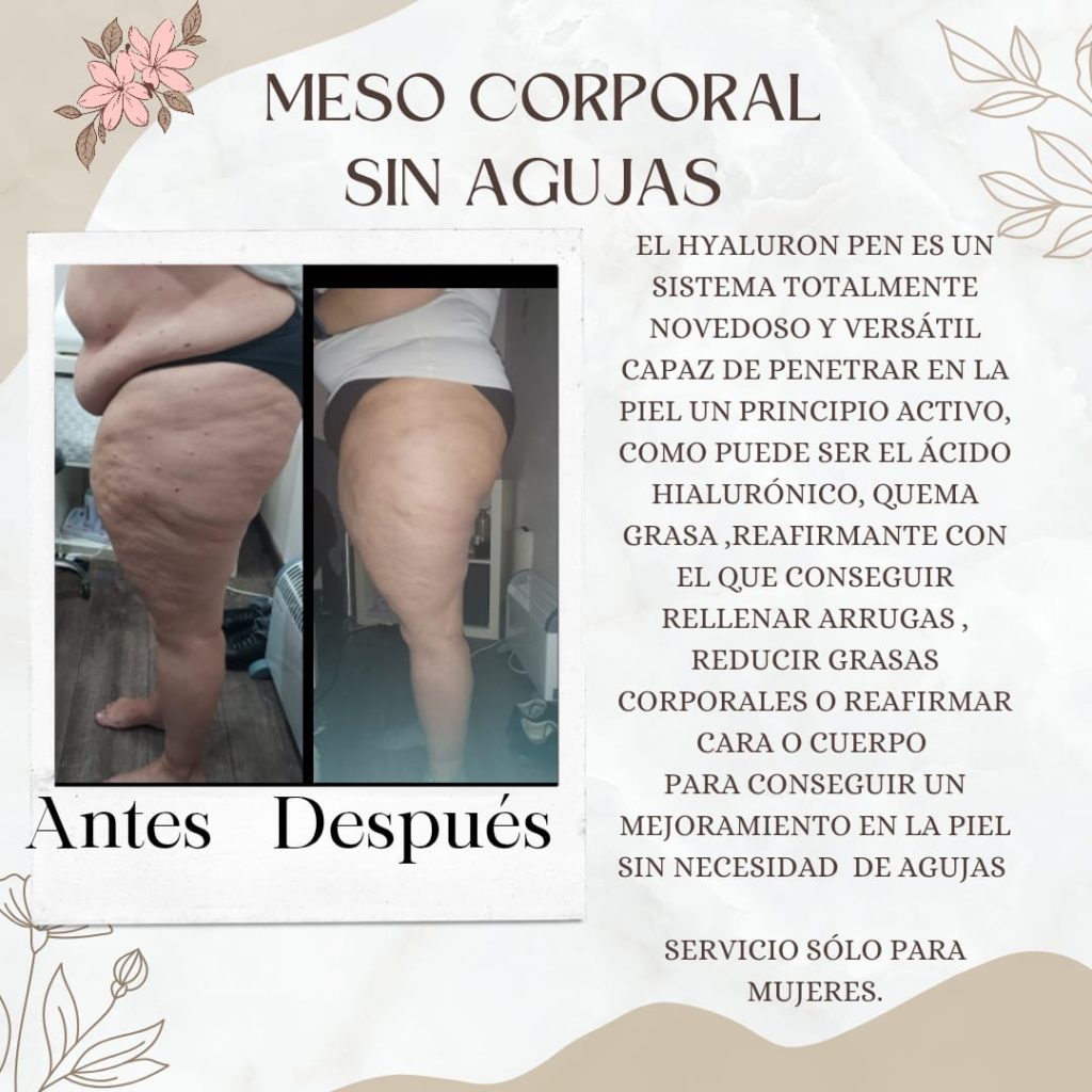 Procedimientos 2