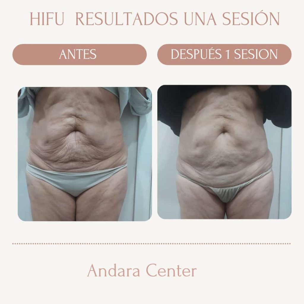 Procedimientos