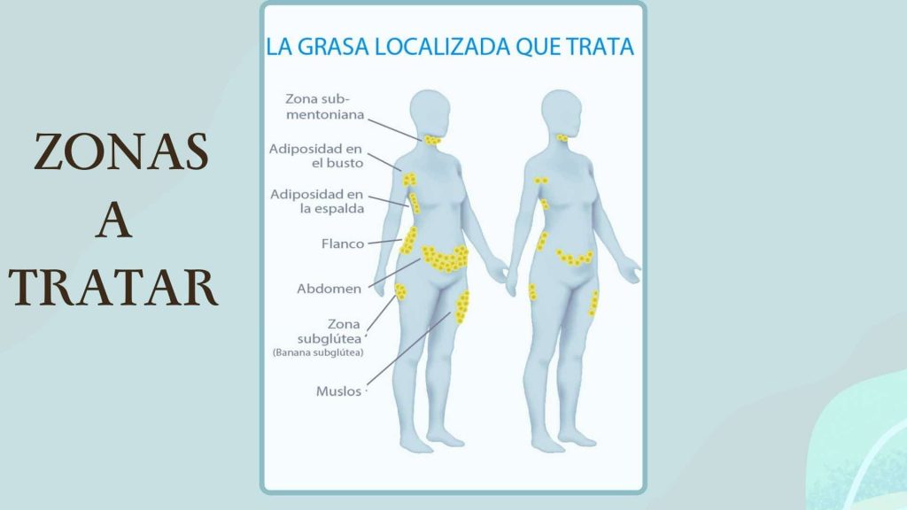 Criolipólisis 2