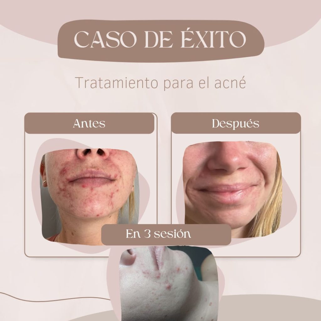 Procedimientos 4