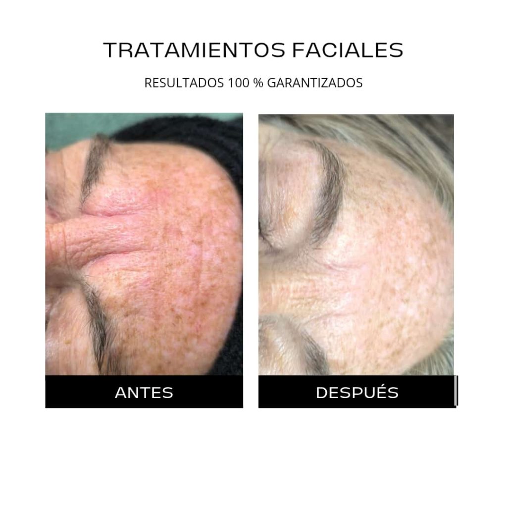 Procedimientos 7