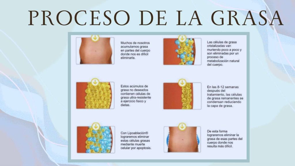 Criolipólisis 4